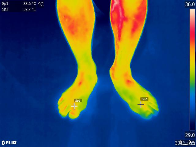 風呂上がりの左右の足の温度を撮影しました